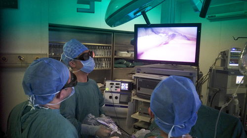 腹腔镜下肝癌切除术联合腹腔镜超声技术 精准治疗肝癌的技术革新与未来展望