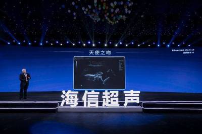 九年磨一剑 海信超声的梦想征程与技术突破
